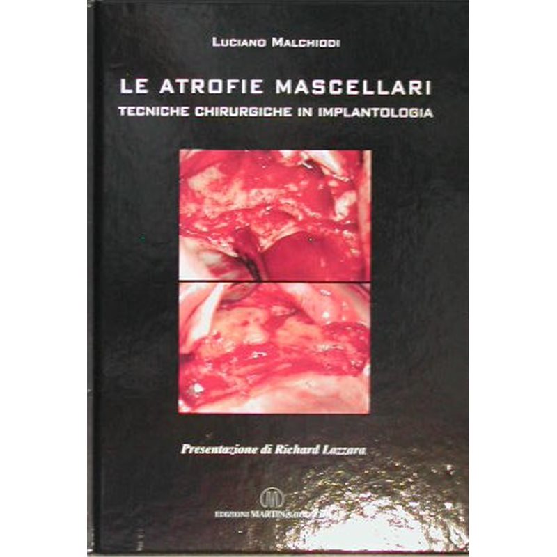 Le atrofie mascellari